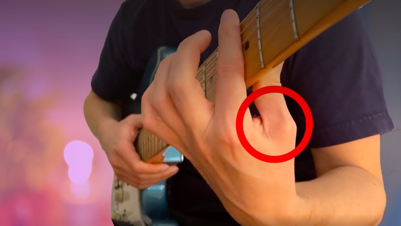 guitar - Advice for positioning my pinky on the fretboard, it is slightly  twisted toward the ring finger - Music: Practice & Theory Stack Exchange